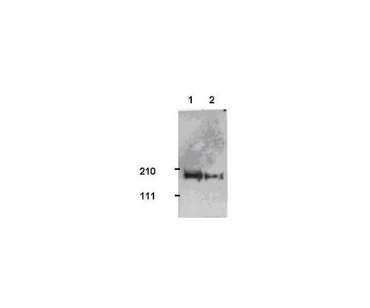 Anti-Tiam1 Rabbit pAb