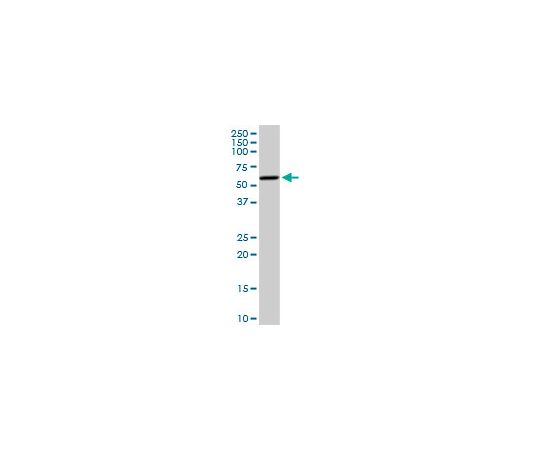 Anti-CYP19A1 Rabbit pAb