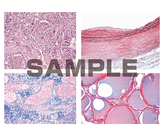 プレパラート ヒトの病理学 基本セット 英語版 1セット（50枚入）