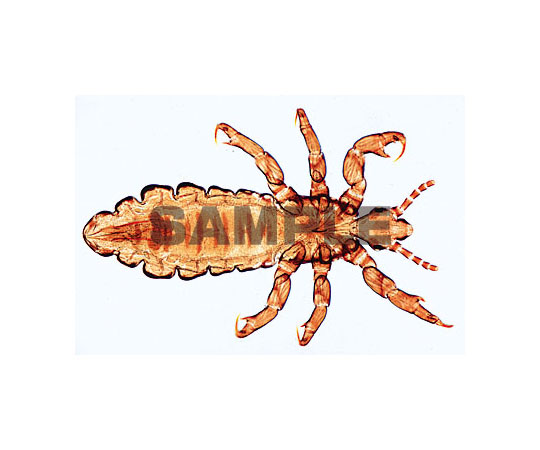 62 9213 31 プレパラート 寄生虫学総論 スモールセット 英語版 W Axel アズワン 62 9213 31 プレパラート 寄生虫学総論 スモールセット 英語版 W Axel アズワン