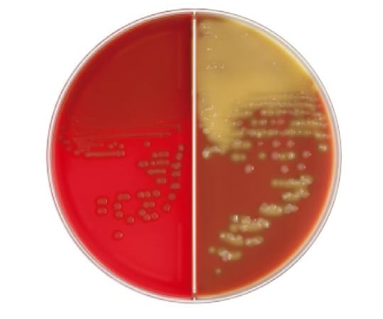 63-6527-83 BD BBL（TM） TSAⅡ5％ヒツジ血液寒天培地/バシトラシン