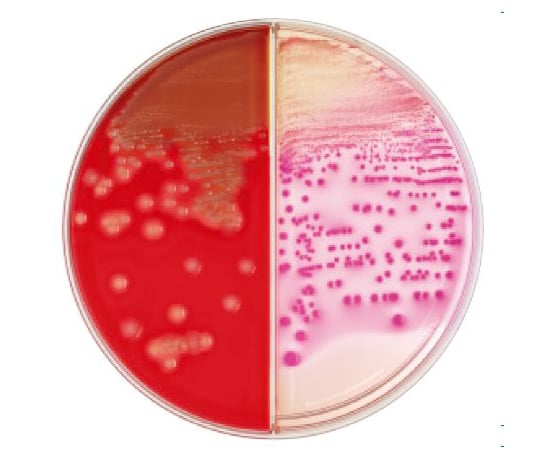 63 6527 86 l Tm コロンビアcna5 ヒツジ血液寒天培地 マッコンキー 寒天培地 枚 Axel アズワン 63 6527 86 l Tm コロンビアcna5 ヒツジ血液寒天培地 マッコンキー 寒天培地 枚 Axel アズワン