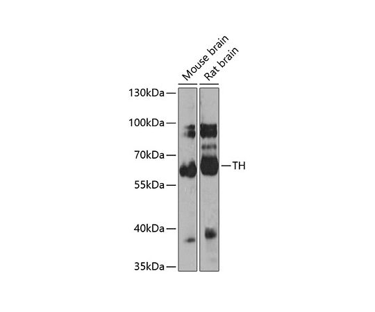 64-2338-03Tyrosine Hydroxylase Rabbit pAbA0028