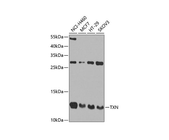64-2338-27Thioredoxin 1 Trx1TXN Rabbit pAbA0053