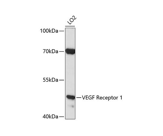 取扱を終了した商品です］VEGFR1 Rabbit pAb A1277 64-2428-13 【AXEL