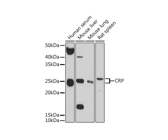 64-2341-09C-Reactive Protein CRP Rabbit pAbA0224