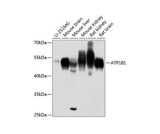64-2414-54 ATP1B1 Rabbit A12403 最大41%OFFクーポン 100uL pAb 期間限定送料無料