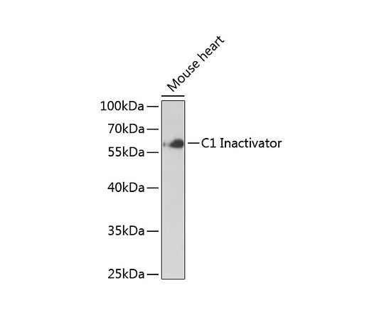 64-2414-67 C1 Inactivator 最大82%OFFクーポン Rabbit A12407 pAb 人気商品 20uL