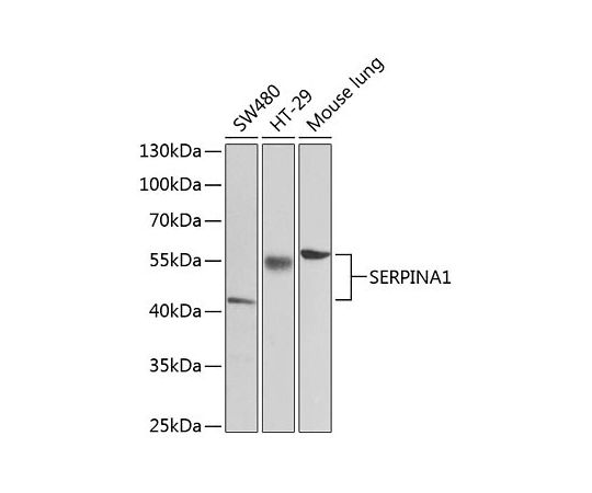 64-2417-54 Alpha-1 数量は多 Antitrypsin SERPINA1 Rabbit A12481 2021春の新作 pAb