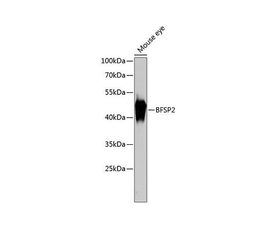 64-2438-26 品質は非常に良い BFSP2 Rabbit 20uL 最大57％オフ！ A13055 pAb