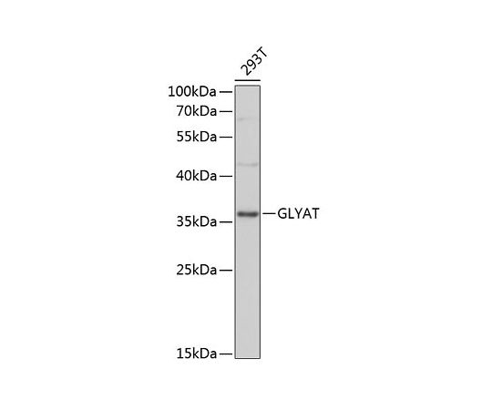 64-2467-89 GLYAT Rabbit 200uL 今年人気のブランド品や A13831 無料長期保証 pAb