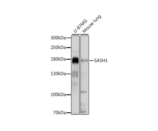 取扱を終了した商品です］SASH1 Rabbit pAb 200uL A15248 64-2518-15