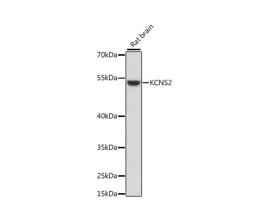 取扱を終了した商品です］KCNS2 Rabbit pAb 50uL A15684 64-2534-32