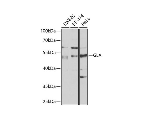 64%OFF 64-4250-57 Galactosidase alpha ●スーパーSALE● セール期間限定 GLA A1700 Rabbit pAb