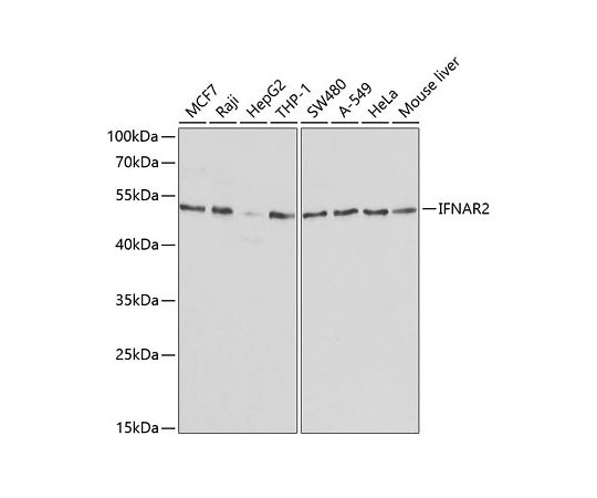 64-5417-88 IFNAR2 Rabbit pAb 50uL A1769