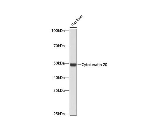 Cytokeratin 20 (KRT20) Rabbit mAb　A19041