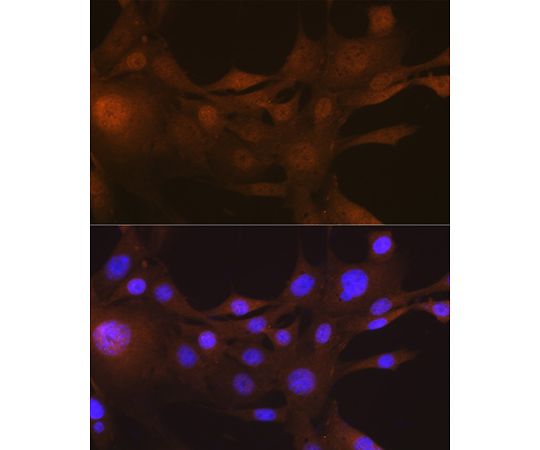 取扱を終了した商品です］FSP1/S100A4 Rabbit mAb 100uL A19109 64