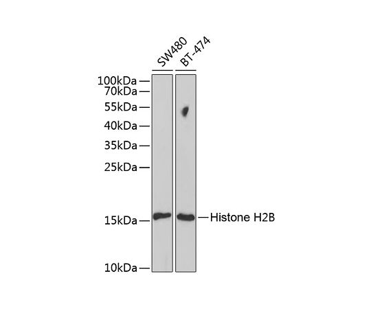 64-5448-85 KO Validated Histone Rabbit 最新作売れ筋が満載 H2B A1958 pAb テレビで話題