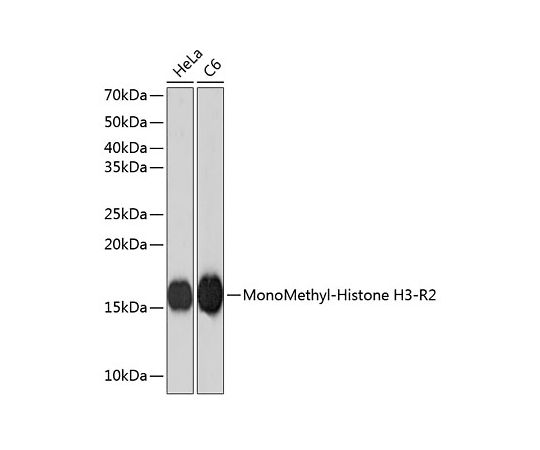 64-5450-47 MonoMethyl-Histone H3-R2 Rabbit mAb 最新発見 【送料0円】 50uL A19645
