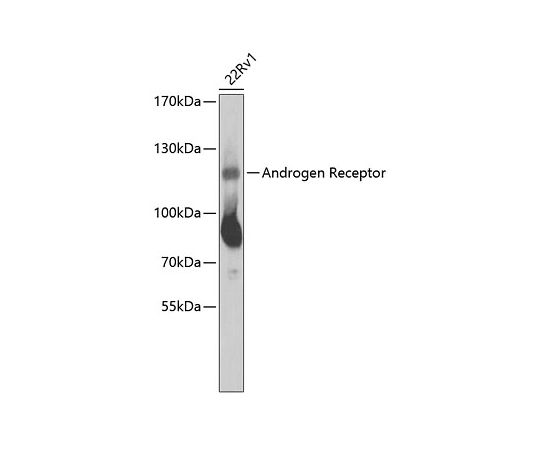 64-5461-63　Androgen　Receptor　Rabbit　pAb　100uL　A2053