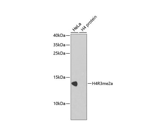 64-5470-30 Asymmetric DiMethyl-Histone 最も完璧な H4-R3 20uL 信憑 pAb A2376 Rabbit