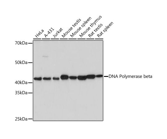 海外限定 64-5470-57 DNA Polymerase beta 100uL A2412 mAb 贅沢 Rabbit