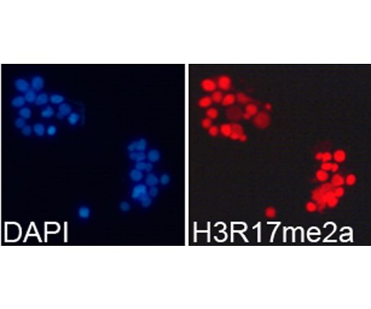 64-5470-76 Asymmetric DiMethyl-Histone H3-R17 Rabbit pAb 20uL A2421 アズワン 即納正規店