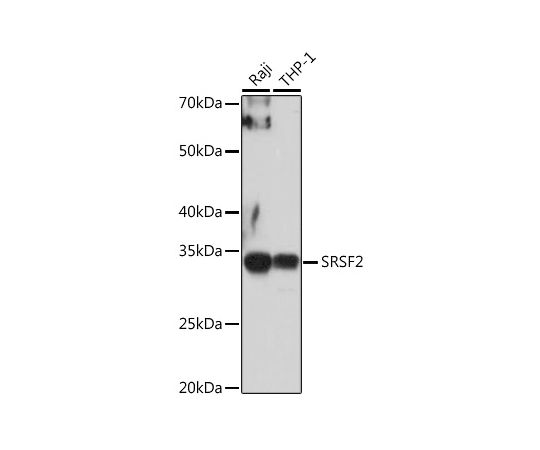 64-5493-38 SRSF2 Rabbit pAb 200uL A3635 アズワン 特価超歓迎