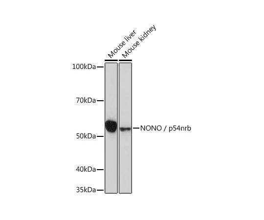 取扱を終了した商品です］NONO/p54nrb Rabbit mAb A3800 64-5496-20