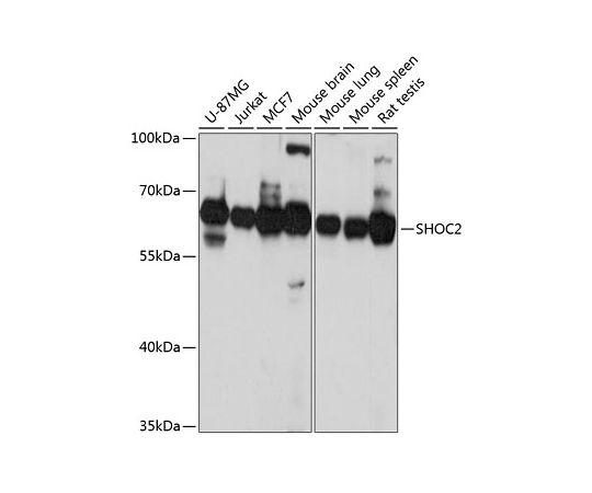 取扱を終了した商品です］SHOC2 Rabbit pAb 200uL A4199 64-5503-54