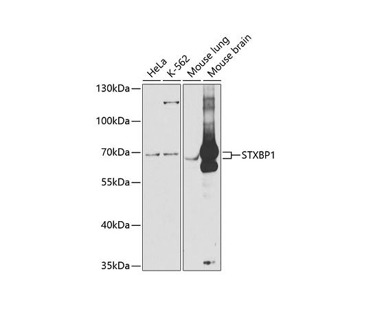 取扱を終了した商品です］STXBP1 Rabbit pAb 100uL A5420 64-5529-06