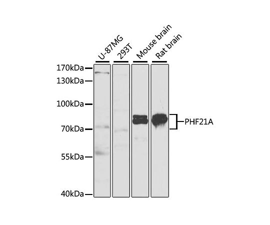 64 5554 Phf21a Rabbit Pab A6330 50ul 67 以上節約