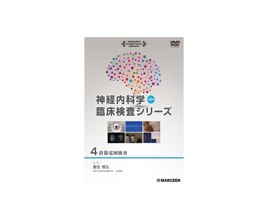 神経内科学臨床検査シリーズ　針筋電図検査