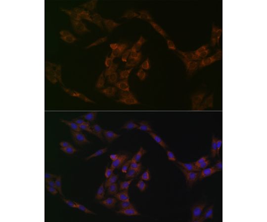 64-7544-48 IRF6 Rabbit mAb 200uL A3209 アズワン 低価特価