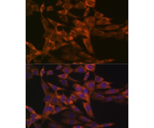 64-7544-48 IRF6 Rabbit mAb 200uL A3209 アズワン 低価特価