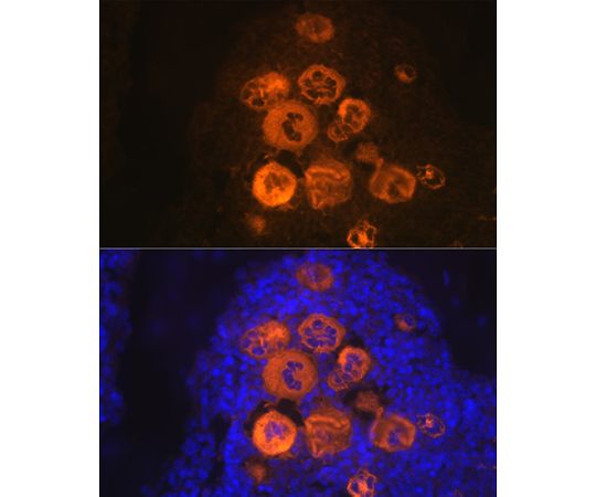 64-7546-89 Rabbit mAb A3694 アズワン CXCL4&x2F;PF4 好評大人気