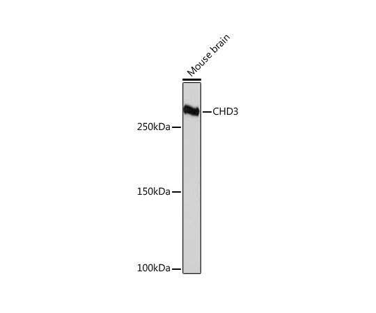 64-7549-32 CHD3 Rabbit mAb 20uL A6118 アズワン 再入荷