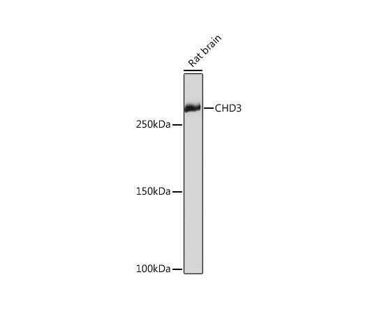 64-7549-32 CHD3 Rabbit mAb 20uL A6118 アズワン 再入荷