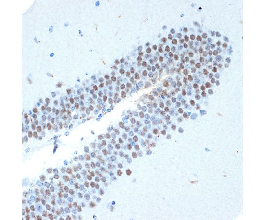 64-7549-32 CHD3 Rabbit mAb 20uL A6118 アズワン 再入荷
