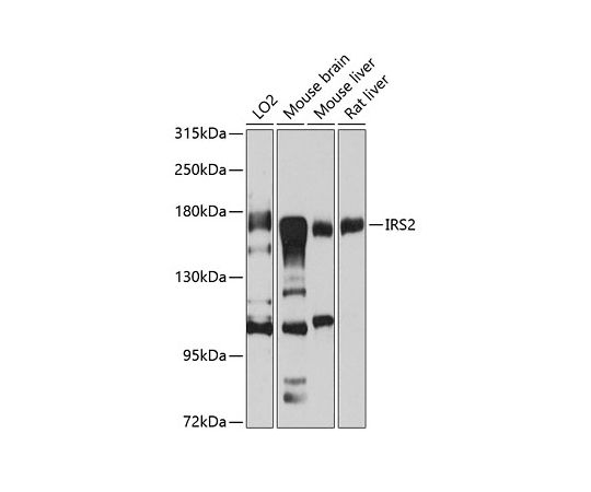 ［取扱停止］IRS2　Rabbit　pAb　100uL　A7945