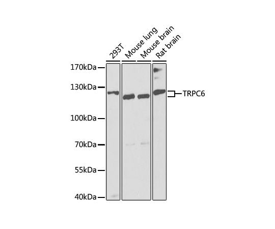 取扱を終了した商品です］TRPC6 Rabbit pAb 50uL A8155 64-7587-58