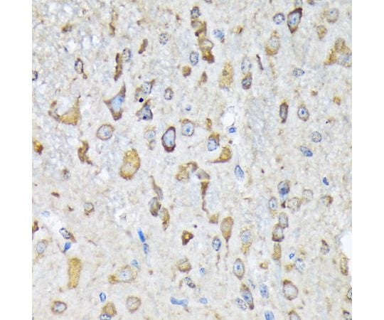 64-7602-84 Rabbit mAb A8648 アズワン LysRS&x2F;KARS 安い再入荷