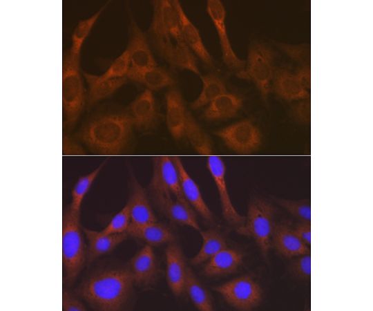64-7602-84 Rabbit mAb A8648 アズワン LysRS&x2F;KARS 安い再入荷