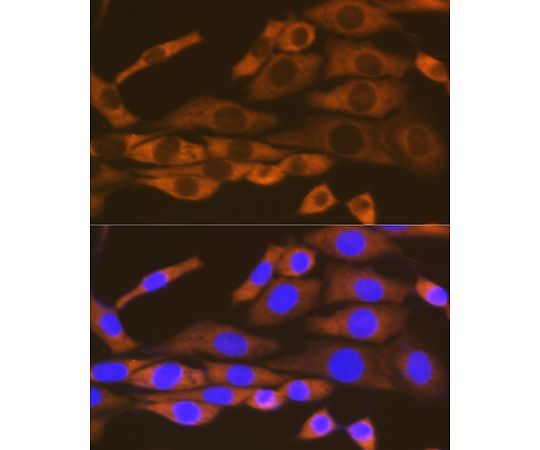 64-7602-84 Rabbit mAb A8648 アズワン LysRS&x2F;KARS 安い再入荷
