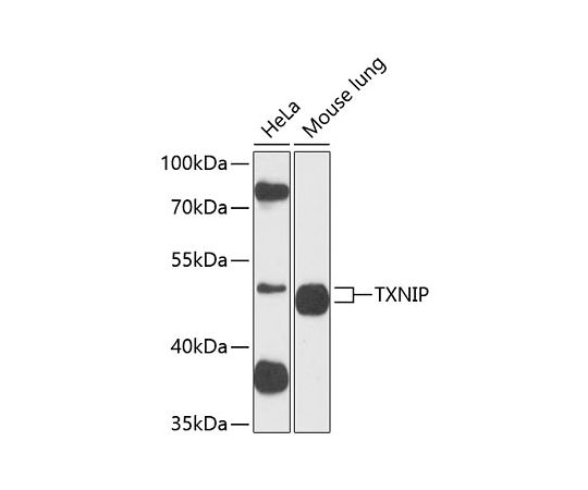 取扱を終了した商品です］TXNIP Rabbit pAb 50uL A9342 64-7614-79