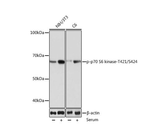 ［取扱停止］Phospho-p70 S6 Kinase 1-T421/S424 Rabbit mAb　AP0502