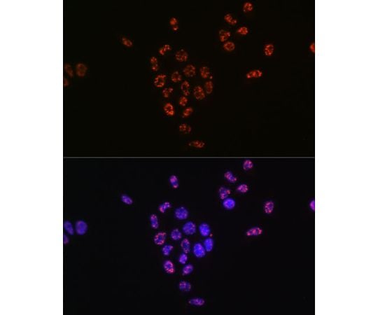 取扱を終了した商品です］Phospho-p70 S6 Kinase 1-T421/S424 Rabbit