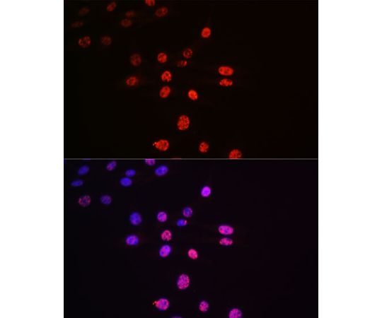 取扱を終了した商品です］Phospho-p70 S6 Kinase 1-T421/S424 Rabbit