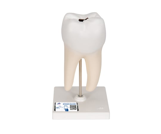 下顎大臼歯（2根）モデル　（3B Smart Anatomy）