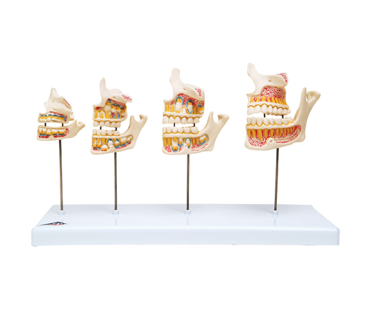 64-9714-96歯の成長過程モデル実物大3B Smart Anatomy D20